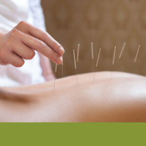 dry-needling-em-rio-verde